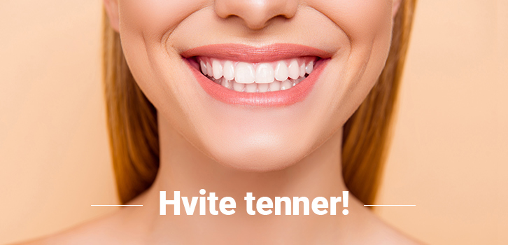 Hvem vil ikke ha hvite tenner og et friskt smil?