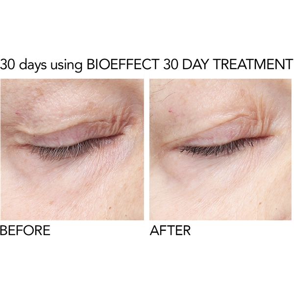 BioEffect 30 Day Treatment (Bilde 4 av 8)