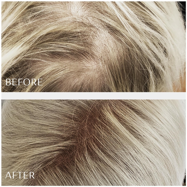 M2 Beauté Hair Activating Serum (Bilde 2 av 5)