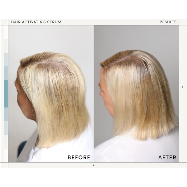M2 Beauté Hair Activating Serum (Bilde 4 av 5)
