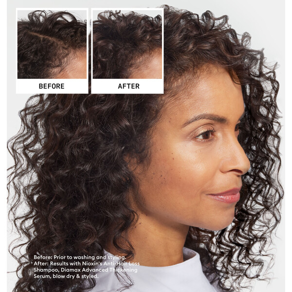 Nioxin Anti Hair Loss Shampoo (Bilde 2 av 6)
