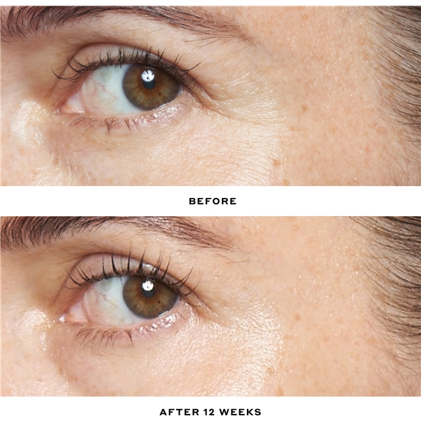 Transform Double Rewind 0,3% Retinol Serum (Bilde 4 av 8)