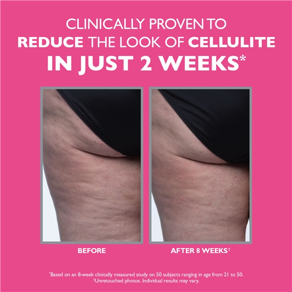 FIRMx® Tight & Toned Cellulite Treatment (Bilde 5 av 9)