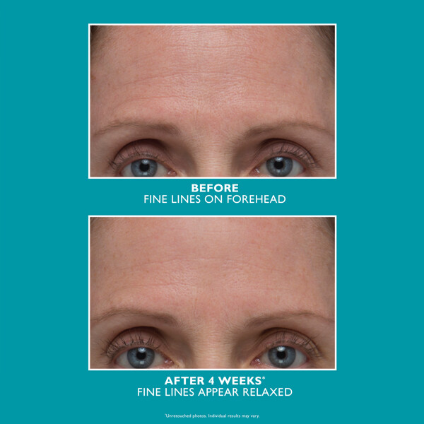 Peptide Skinjection Amplified Wrinkle Fix Serum (Bilde 3 av 3)