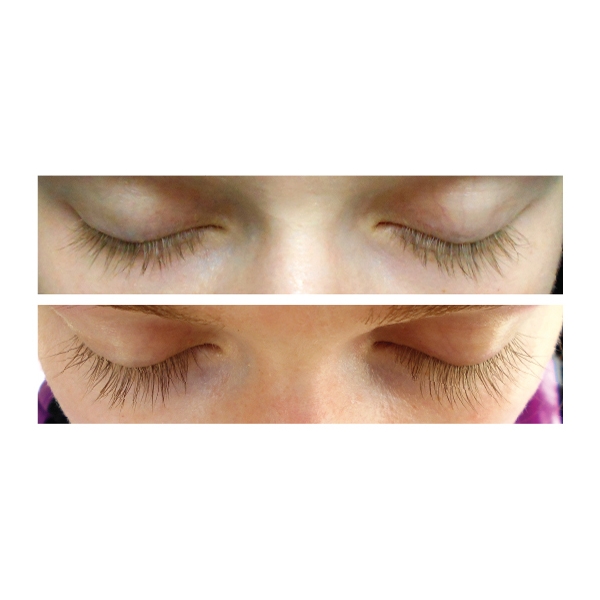 Xlash Eyelash Serum (Bilde 2 av 2)